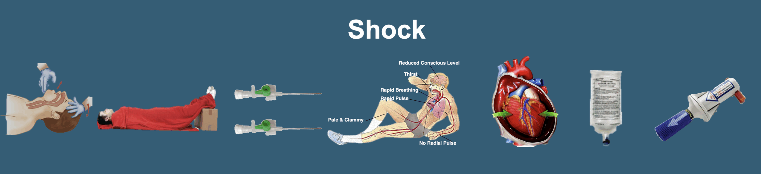 Shock - (First Aid) - Trauma Training
